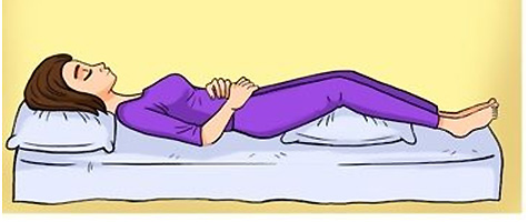 Postura adecuada para dormir con trocanteritis
